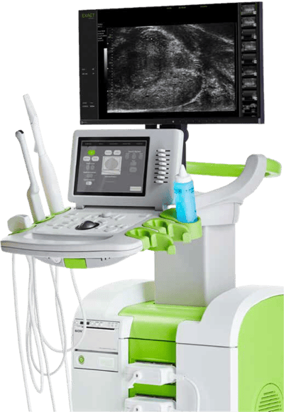 ExactVu Micro-Ultrasound system